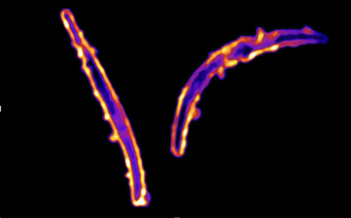 Plasmodium falciparum sporozoites appear under magnification as researchers study how monoclonal antibodies (orange/yellow) bind to the malaria parasite (blue/purple).